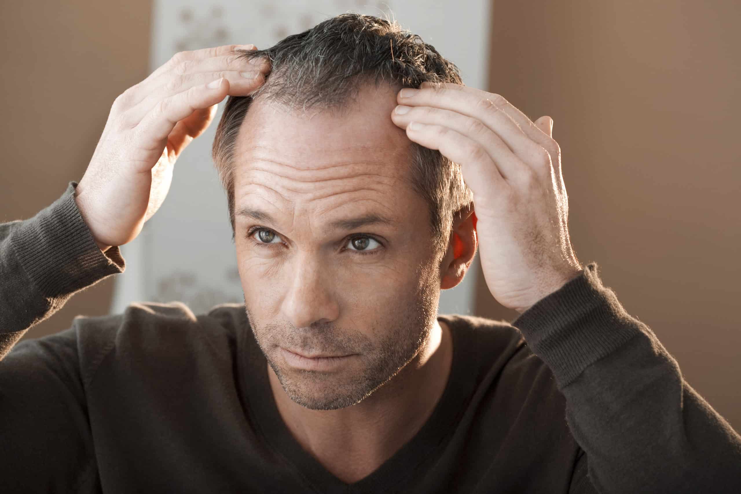 Male Pattern Baldness Treatment Utah | Regeneration Health