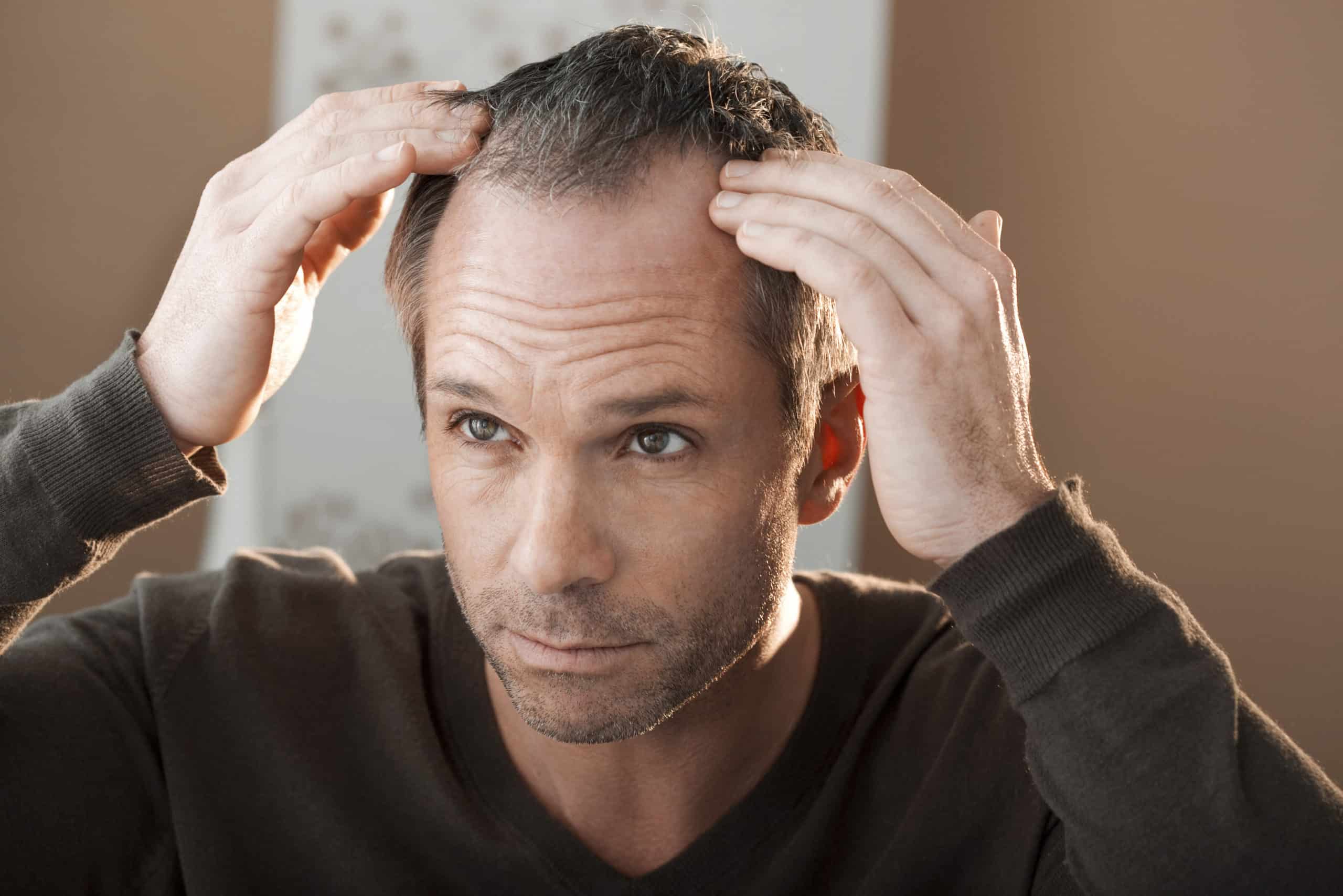 2. 50 Classy Haircuts and Hairstyles for Balding Men - wide 7